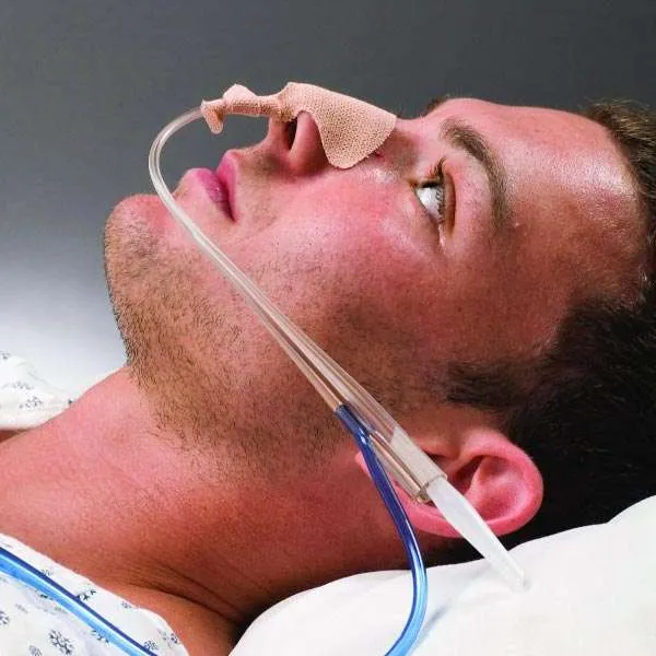 Ryle’s Tube (Insertion/Removal)