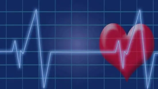 ECG