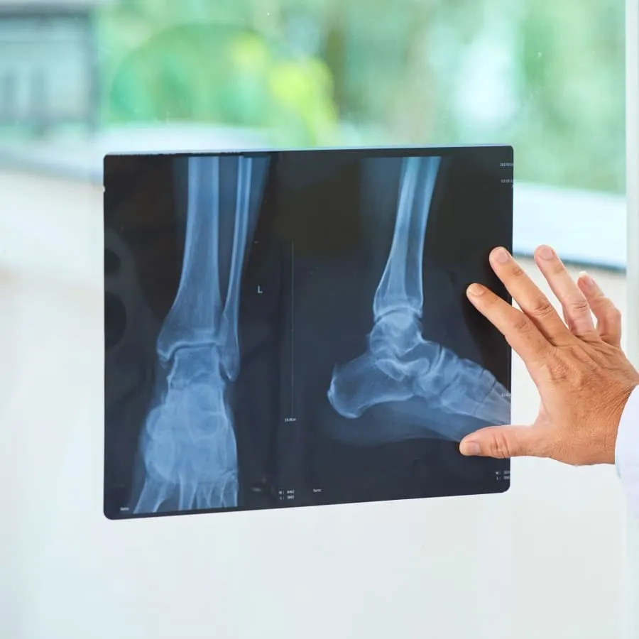 X-Ray (Chest/Bones/Spine etc)