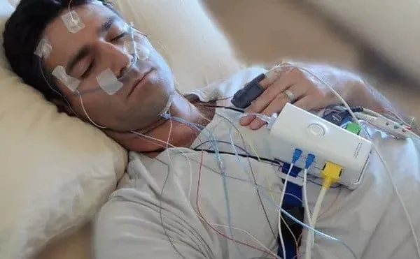 Sleep Study (Poly Somaiography)